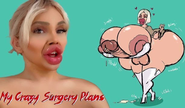 Plastic Surgery Addicted: These Surgery Plans Vienna Xtreme