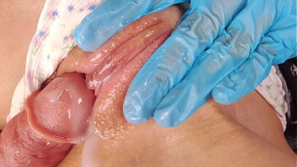 Pervert Doctor Slaps Pussy Fingers Teen