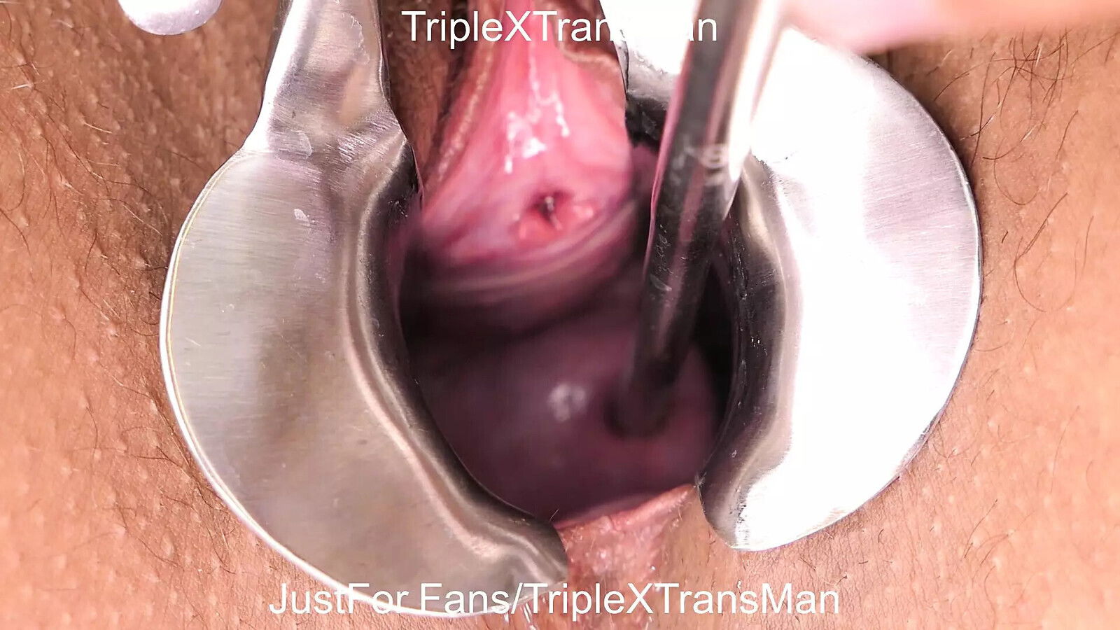 Extreme Cervix Penetration, Sounds, Speculum, Uterus Dilation