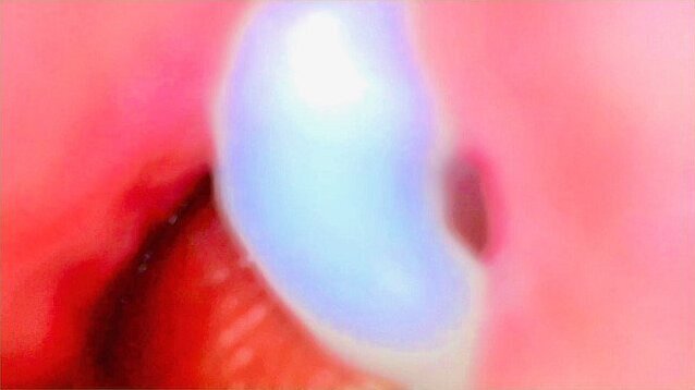 Endoscope Camera Inside Pink Pussy Records Fills With Cum💎 Couple Keyla Lucas