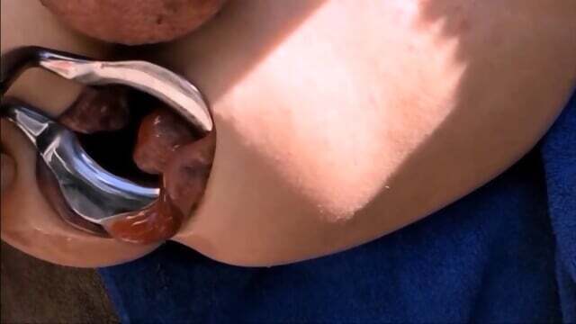 Extreme Fisting Loose Sloppy Asshole