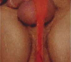 Cute teen body struggling to keep his big floppy cock and huge swollen balls from accidently escaping his tiny beach shorts which ends in a hard penis and a cumshot