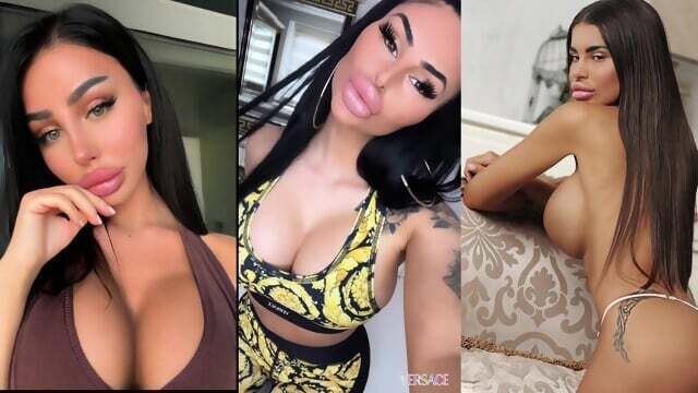 Bimbo with FAKE LIPS