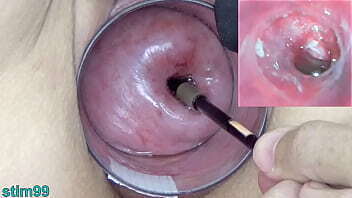 Mature Milf Cervix Play with Endoscope Japanese into Uterus