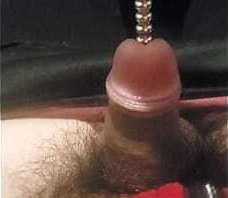 尿道サウンドロッド