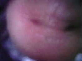 日本人男性の尿道カメラ挿入「マイクオフ」