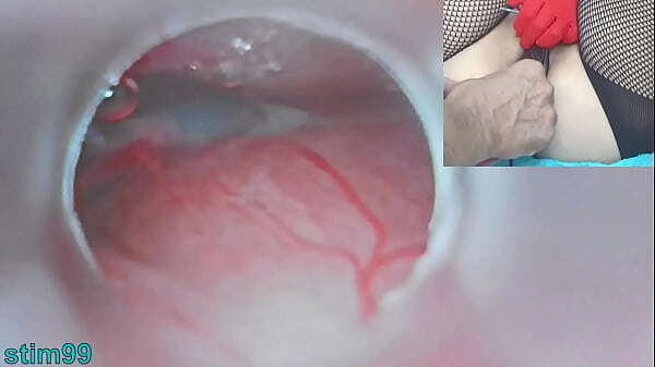 Japanese Insemination with into Uterus Endoscope Camera Cervix watch inside womb Uncensored