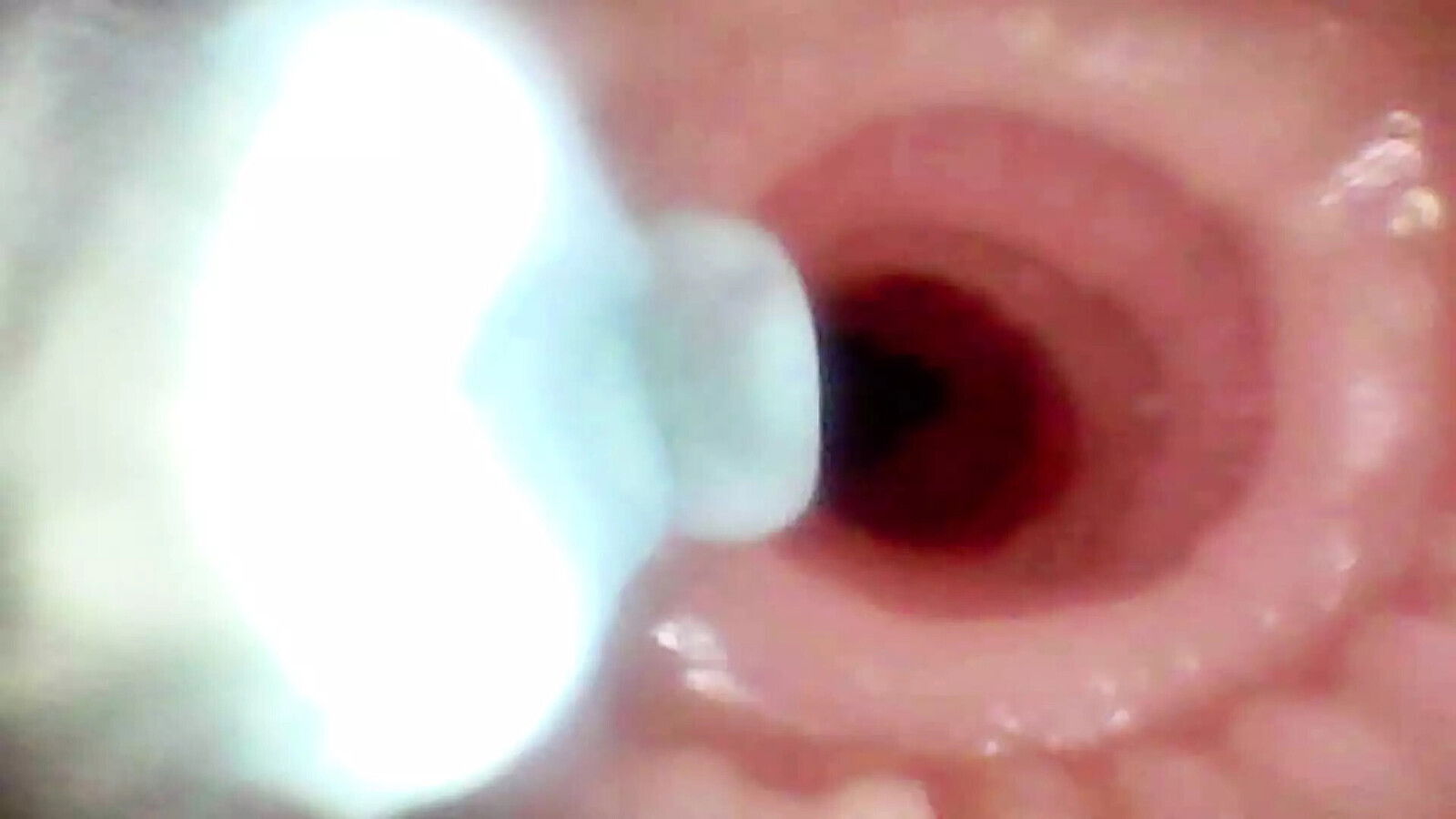 detailed examination Lopuza93 oral cavity using endoscope camera.