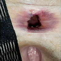 Lala Licious - Gapes &amp_ Farts