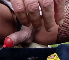 &Eacute_largissement Foreskin