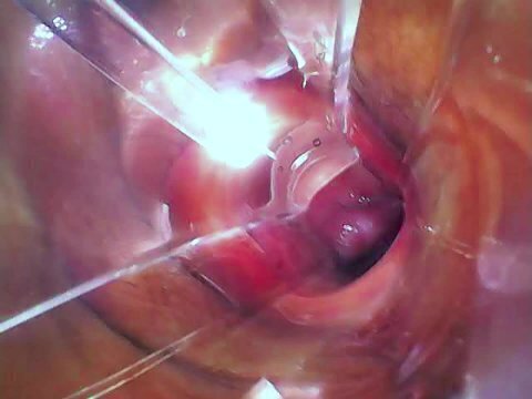 Deep pussy. Crem's search.