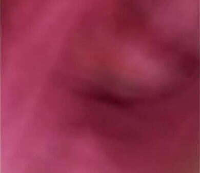 Depila&ccedil_&atilde_o