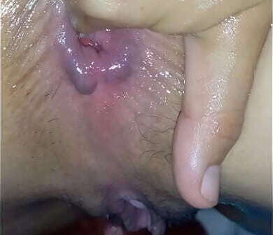 Marbels Inside Rectum best have