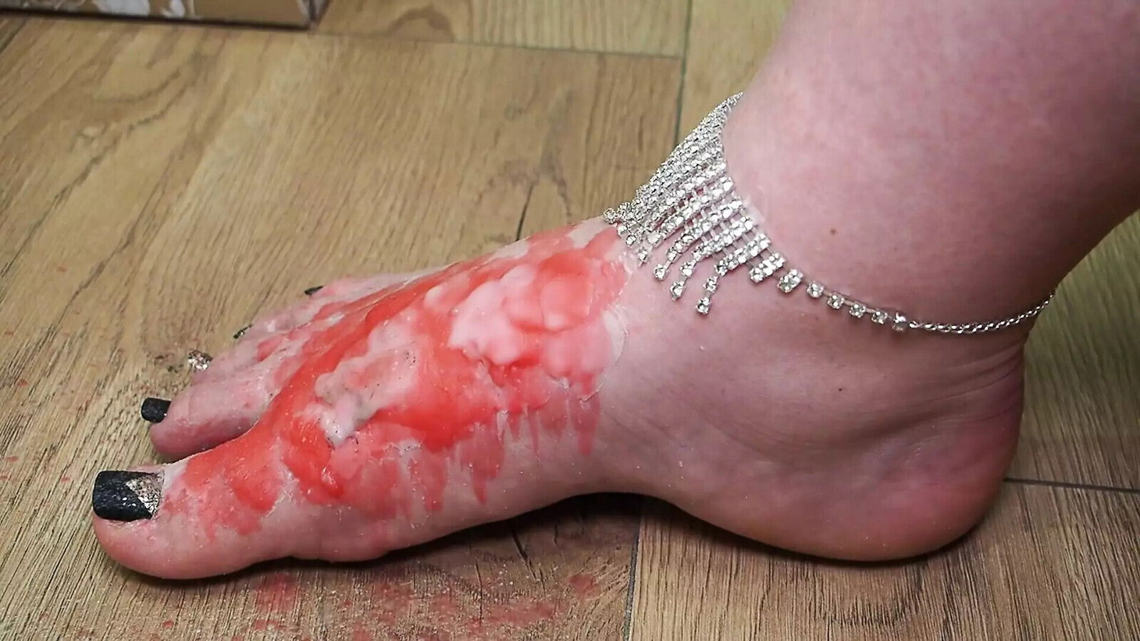 Fire Hurt: Worship Through