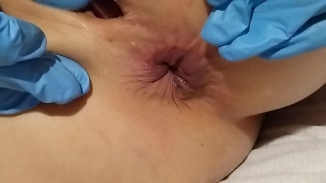 started like when fingers just fingers Close view