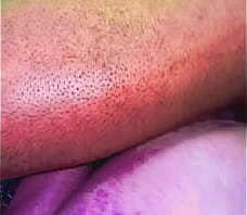 Interracial Backshots