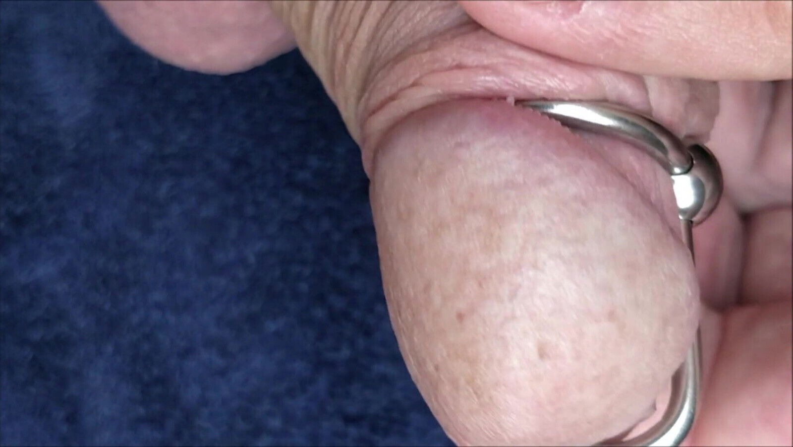 extreme peehole gape sounding