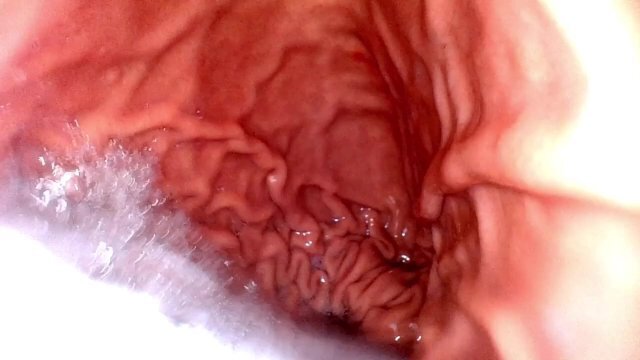 VORE ENDOCAM - swallowing you whole into my empty starved stomach (MALE VORE)
