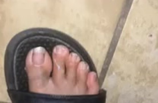 Feet Slapping With Slippers