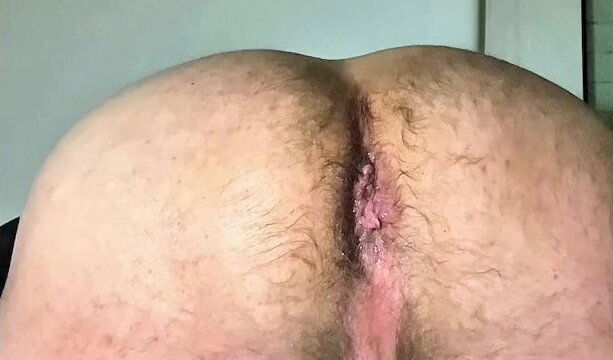 gape issue