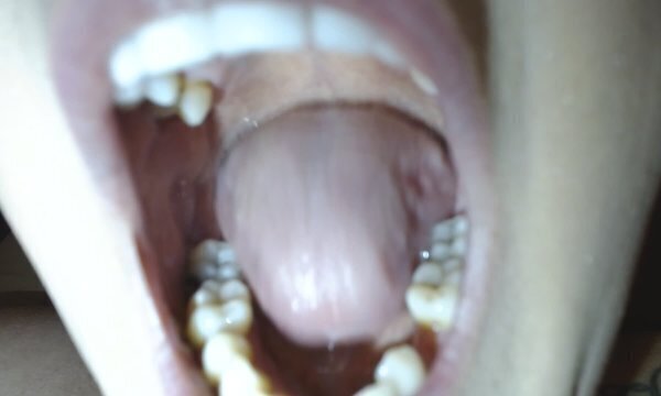 Yawns Inside Mouth Yawning Naked Milf