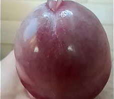 Macroscopie de mon gland humide