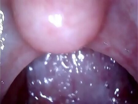 内視鏡で男の身体観察