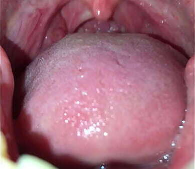 男の臭い口臭(ゲップつき)