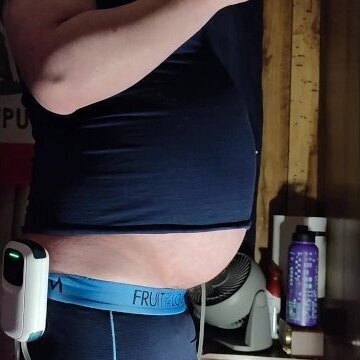 2-23-2025 Belly Inflation