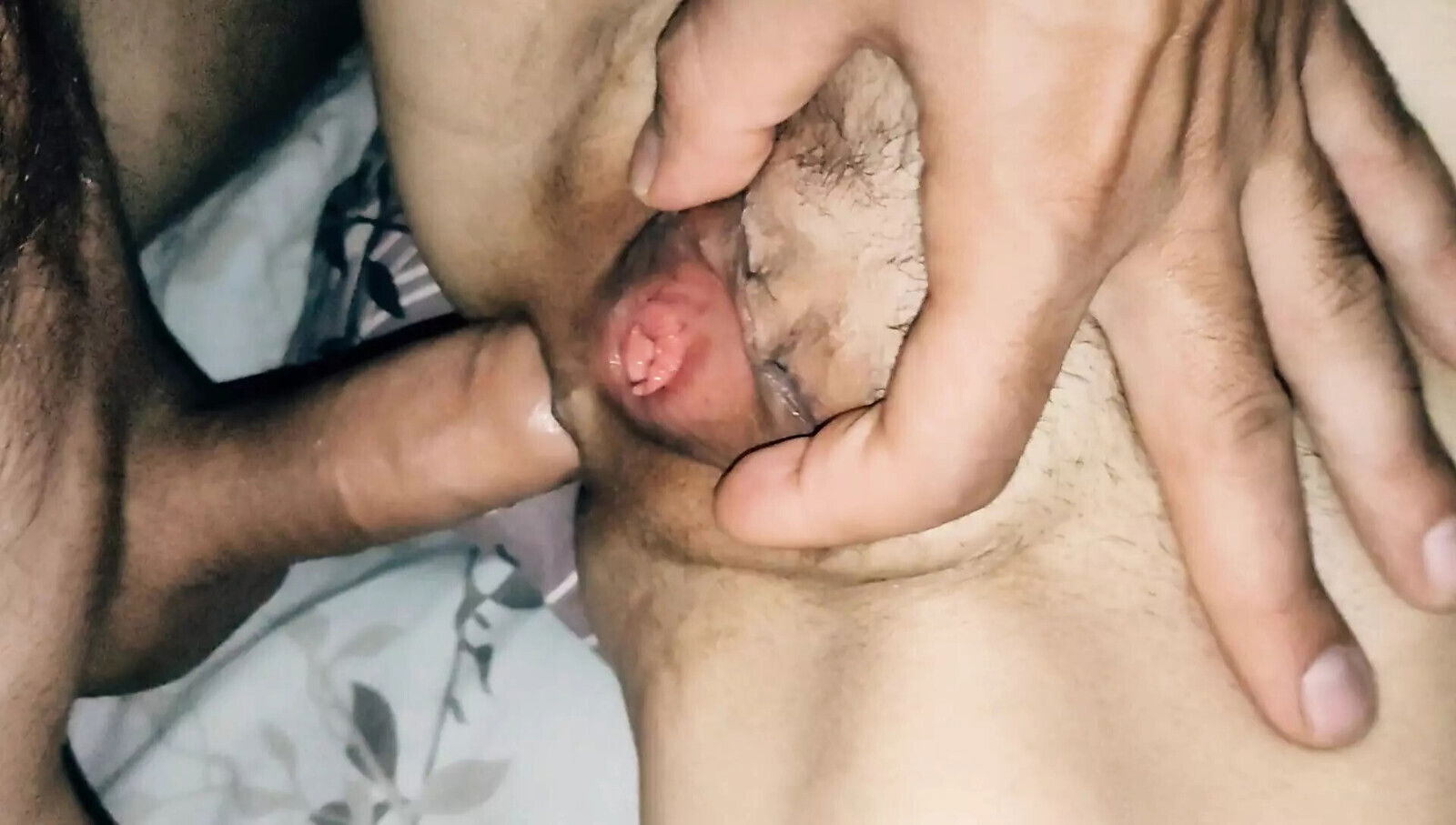 Skin girl with beautiful