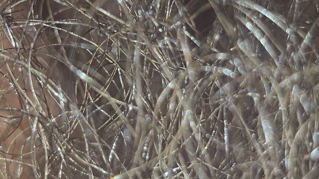 Forest Of Coconut Oiled Pubis Asmr Straight Edge Healthy Warmth Watching Dangling Shorties