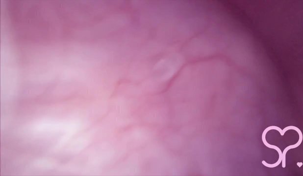 Fucked Camera Bladder Crazy Bulge! Full Video Manyvids Fansly