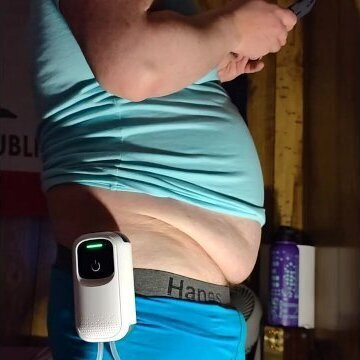 3-10-2025 Belly Inflation