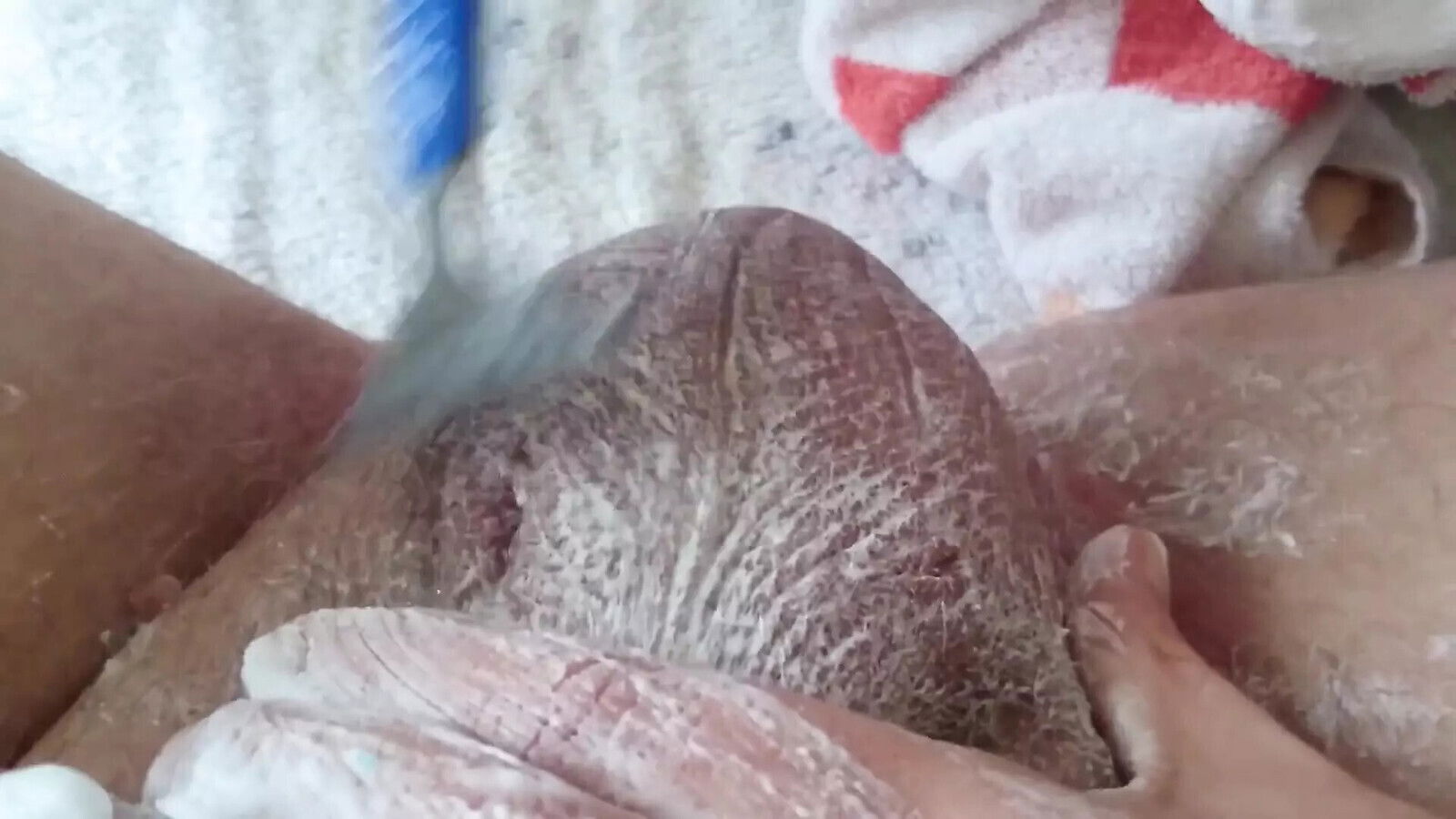Nursing Shave From Asshole Scrotum