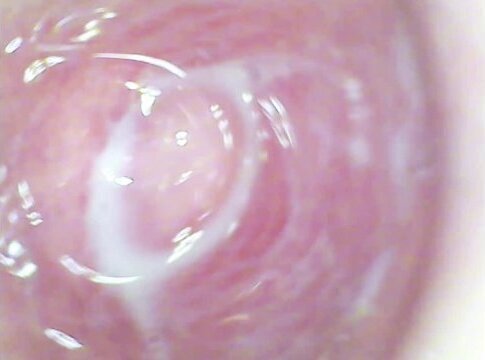 Camera deep inside pussy captured intense female orgasm!!