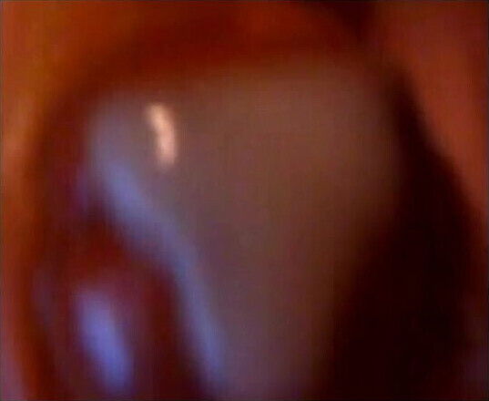 Head Close Shots Compilation