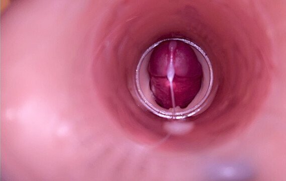 Female Insemination Internal Camera Captures Deep Male Ejaculation