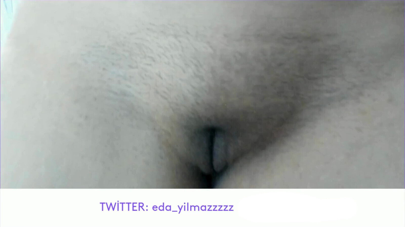 HAIRY PUSSY- TITS- TURKISH MILF- TURKISH DISCLOSURE- DISCLOSURE