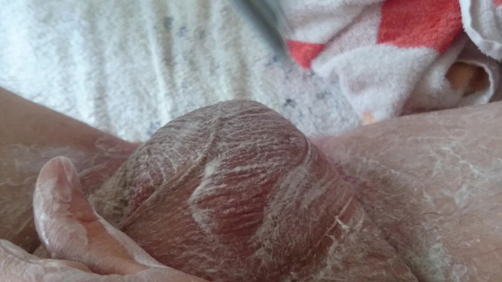 Nursing Shave From Asshole Scrotum