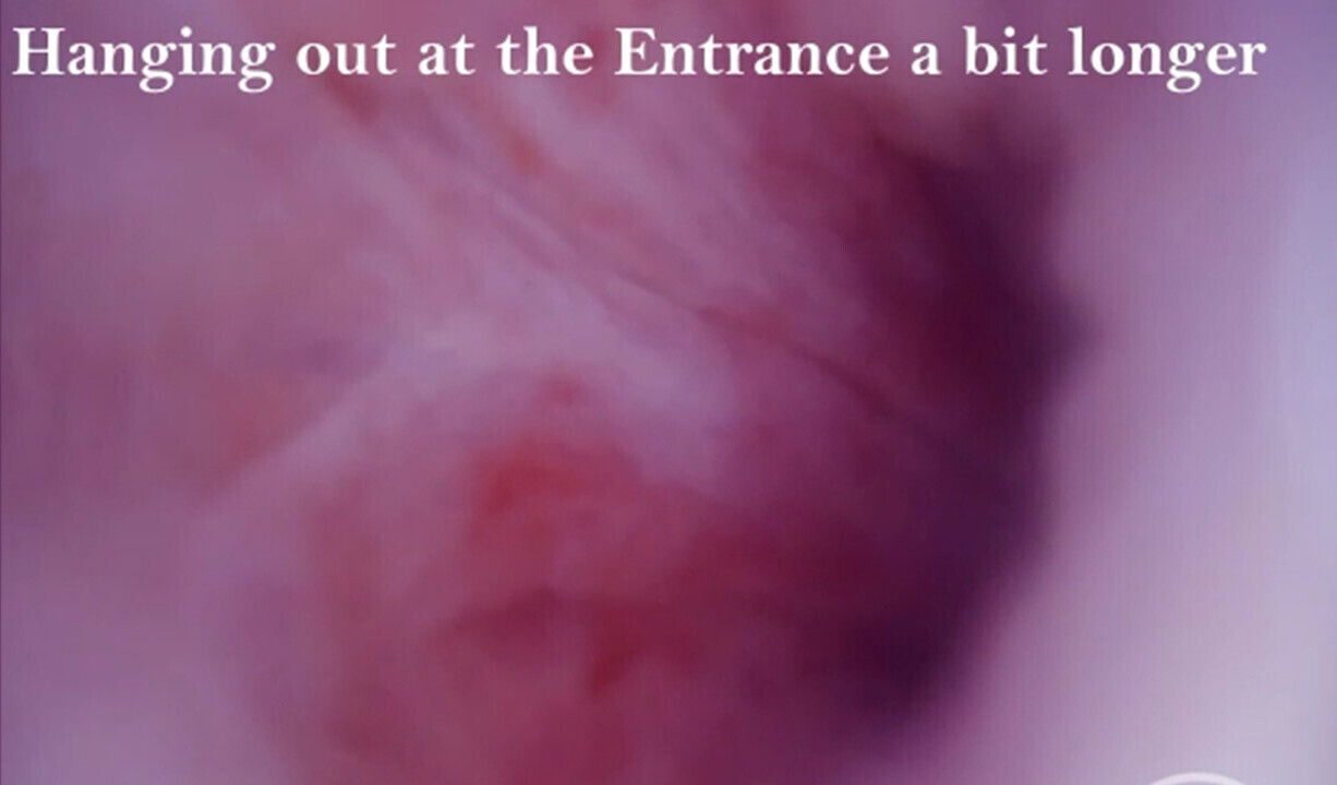 Swim through Dick when