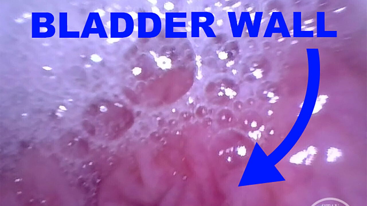 INSIDE POV: Inflating Bladder with Air!