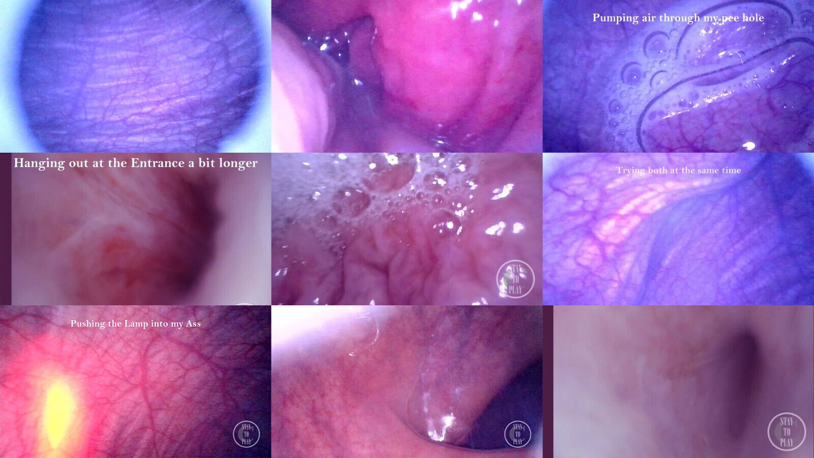 COMPILATION: Endoscope Dick, Bladder