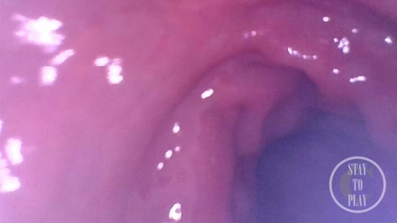 Extreme Deep Examination