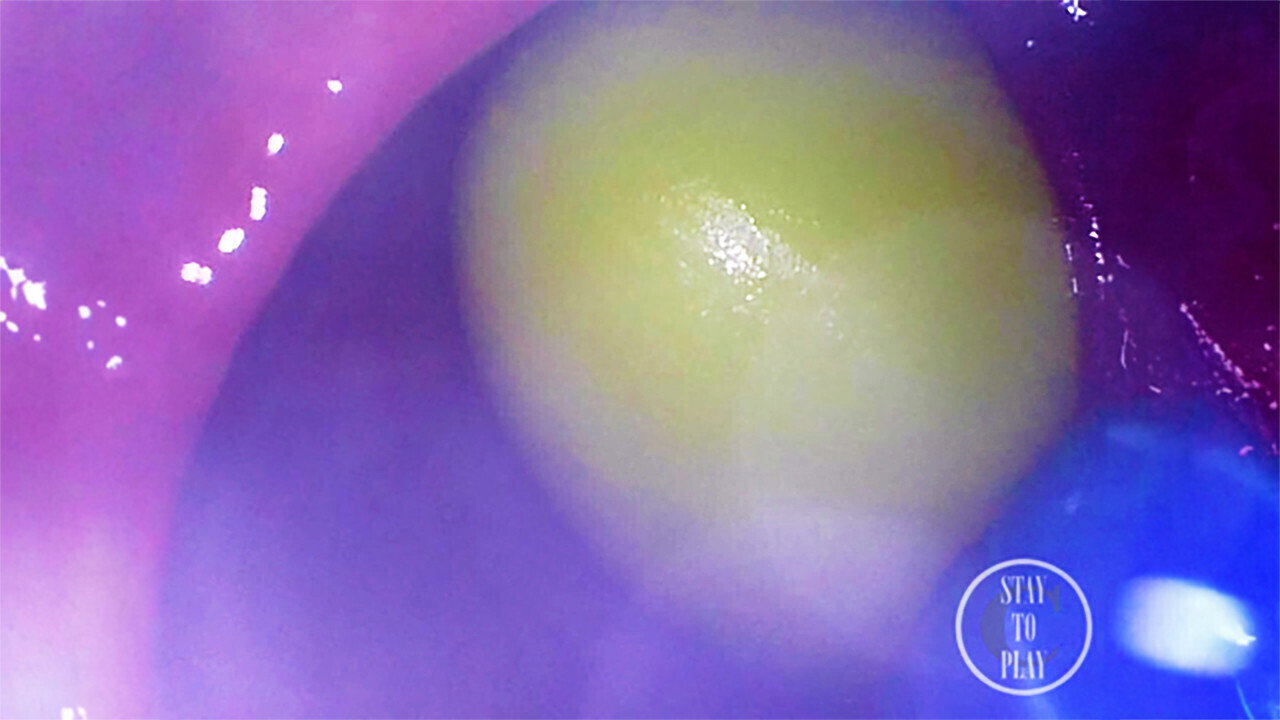 INSIDE POV: Eggs disappeared hole