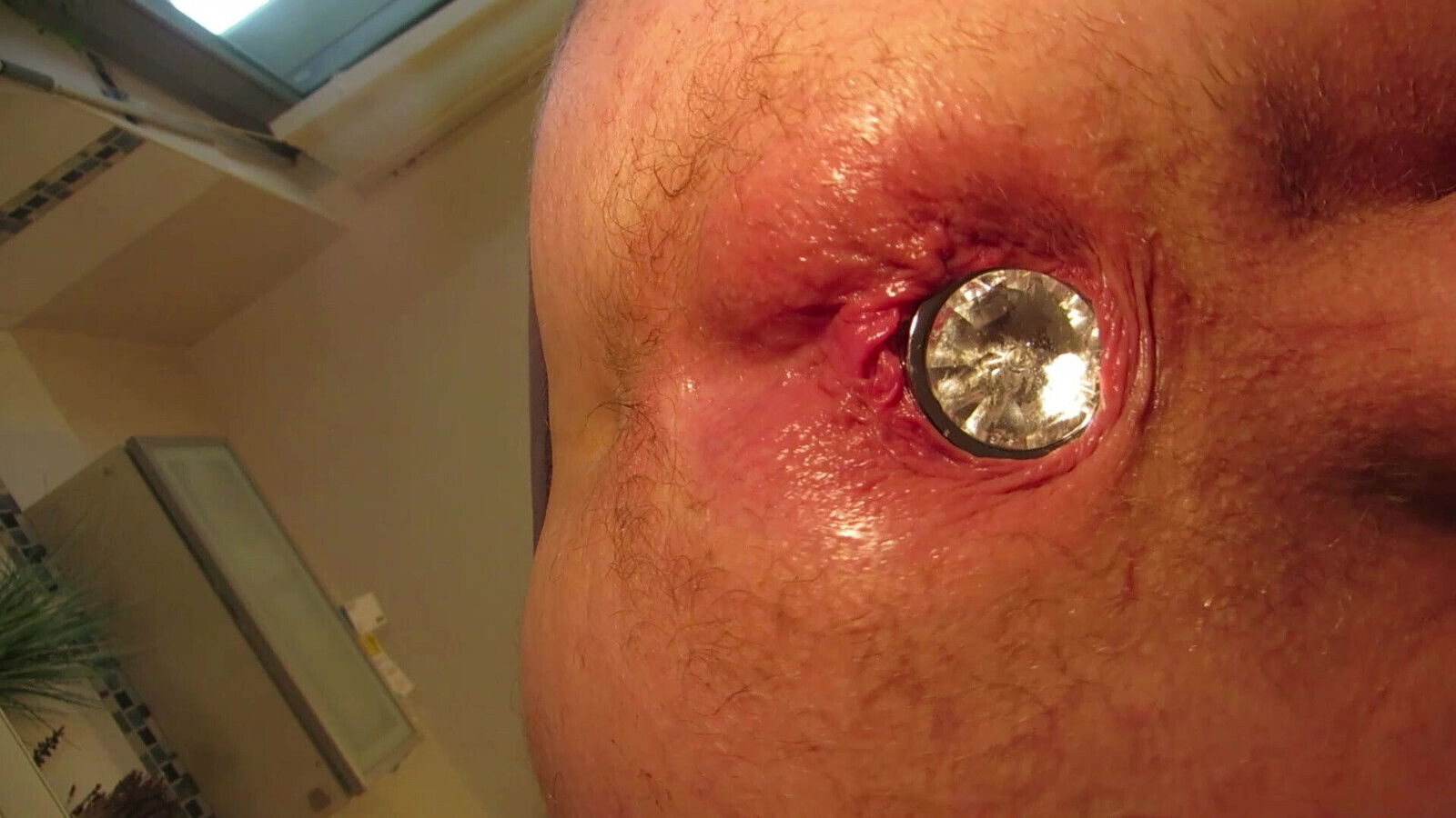 wifes husbands prolaps