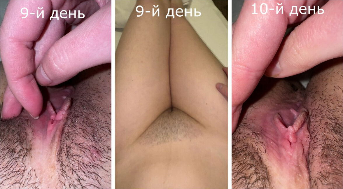 ASMR Dirty talk hairy unwashed close-up, haven't shaved days! Part