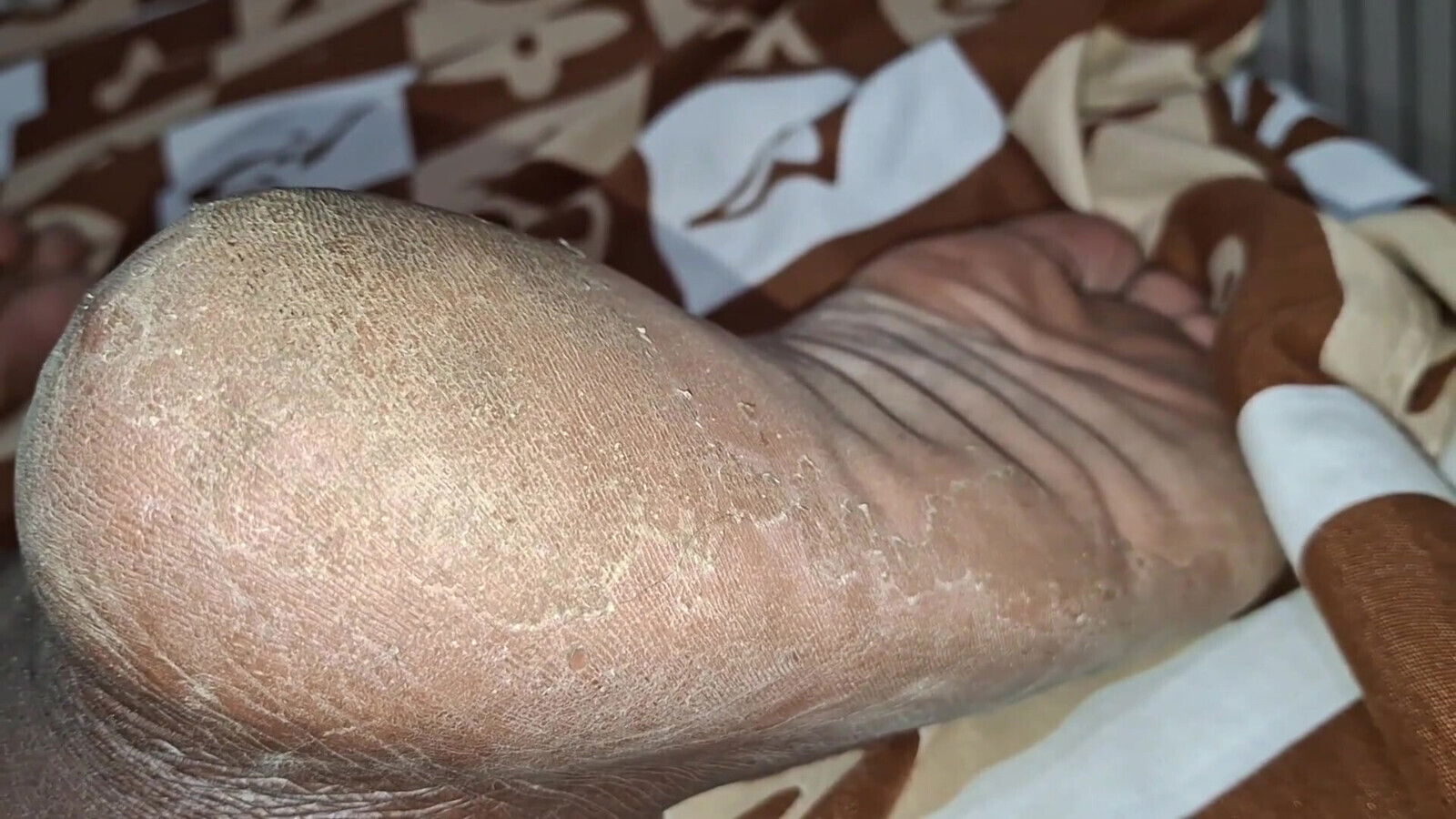 Legs Asked Cuckold Come Lick Cuckold Album Available There