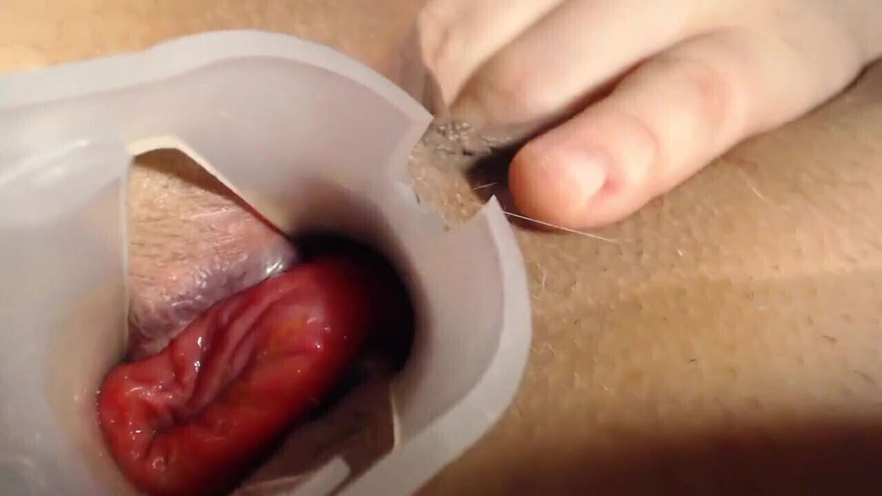 Long play, prolapse close squirt