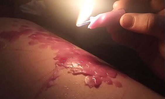 play (Purple) Masochist transman drips thick thigh while wearing knee thighs