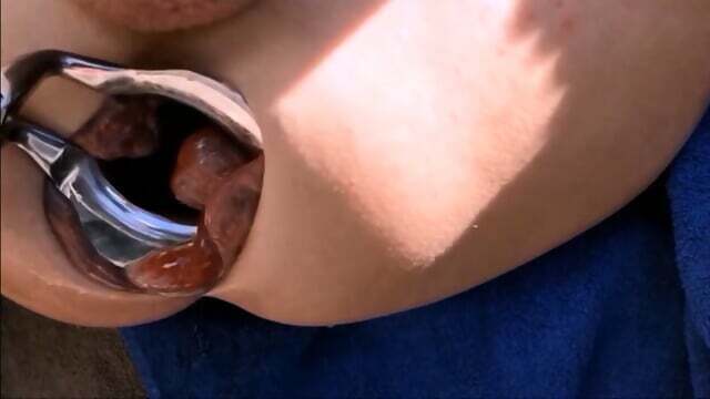 Extreme Fisting Loose Sloppy Asshole